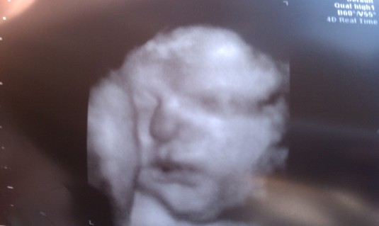 Baby Richey!!! 36 Weeks and 7lbs